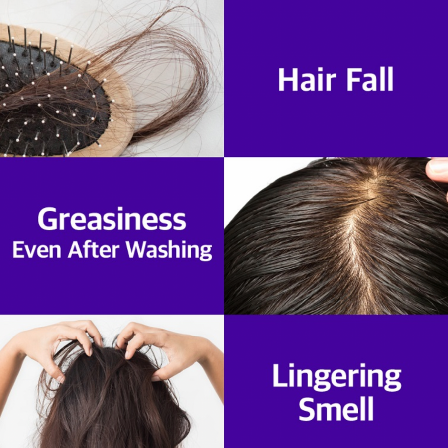 RYO Hair Loss Expert Care Scalp Scailing Cleanser, 145ml/ 4.9fl.oz
